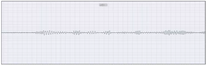 高分辨率干擾信號頻譜識別 高分辨率干擾信號頻譜識別